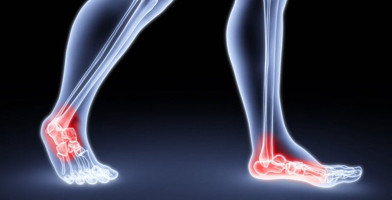 Causes of Ankle Pain Shoes
